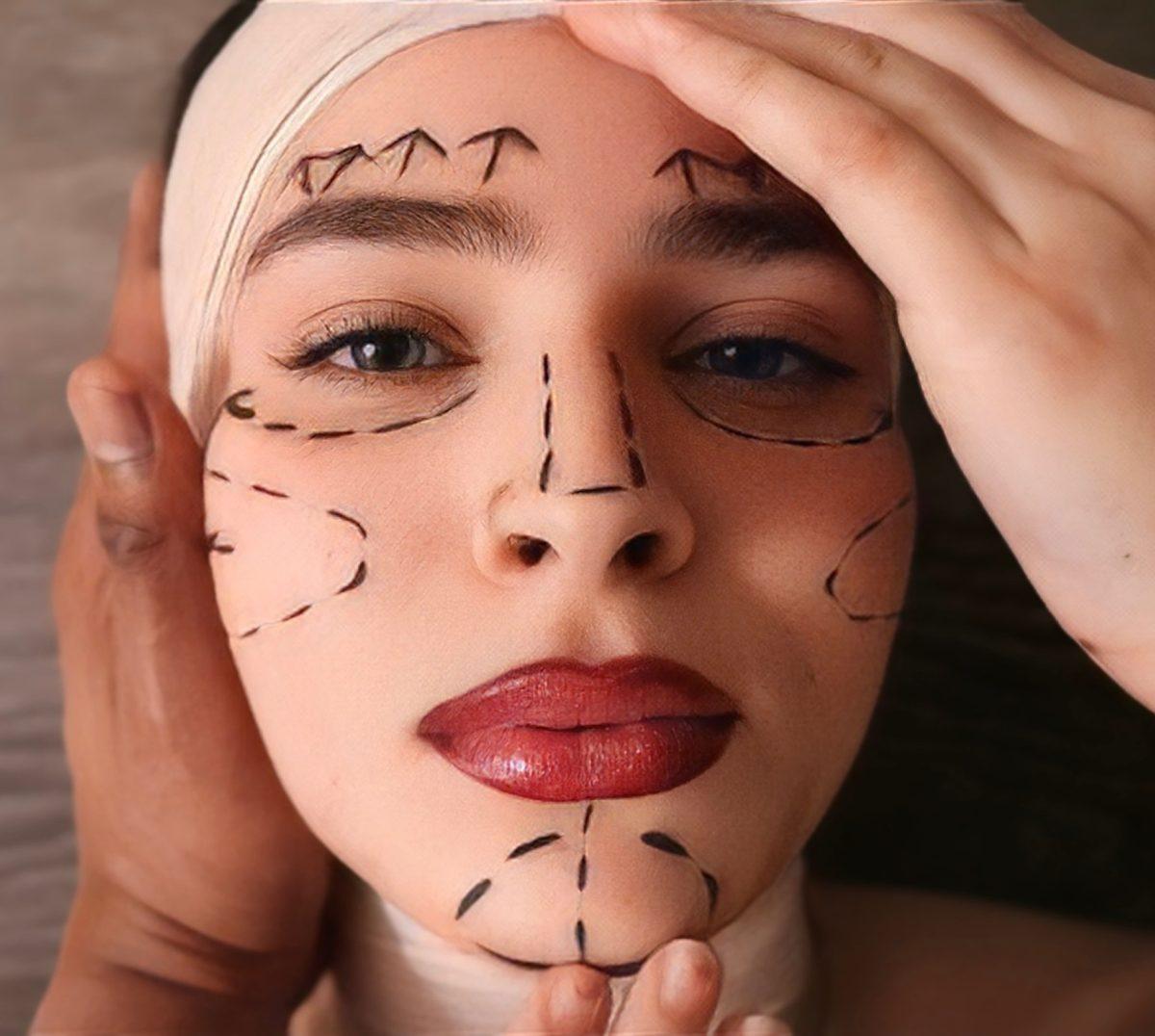 Bodies without Botox are better